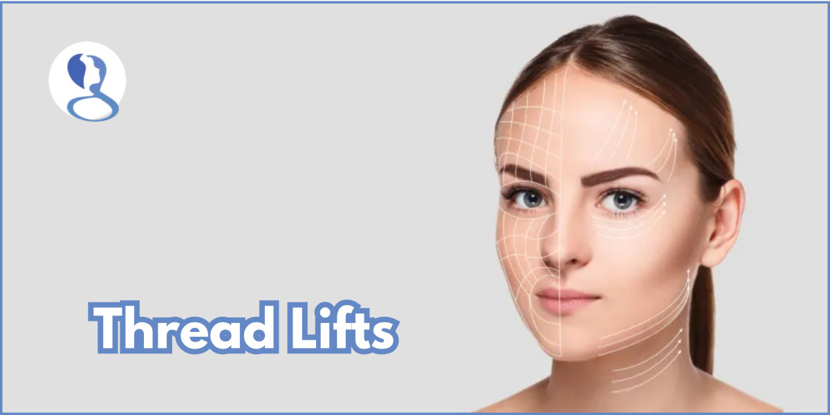 Thread lift: An affordable and non-surgical way to achieve youthful skin