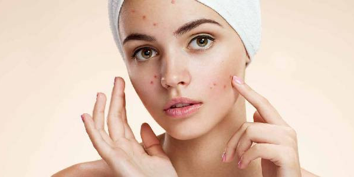 Dermatologist in Gurgaon