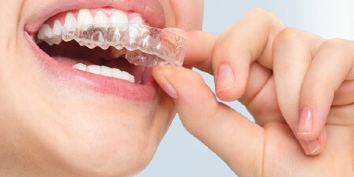 Invisible Braces: The Clear Path to a Perfect Smile