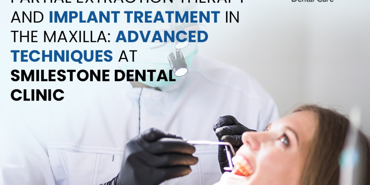 Partial Extraction Therapy and Implant Treatment in the Maxilla: Advanced Techniques at Smilestone Dental Clinic