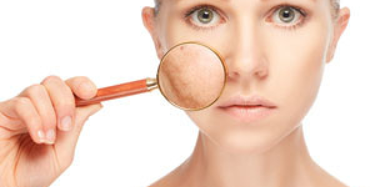 Understanding Pigmentation Disorders and Their Treatment