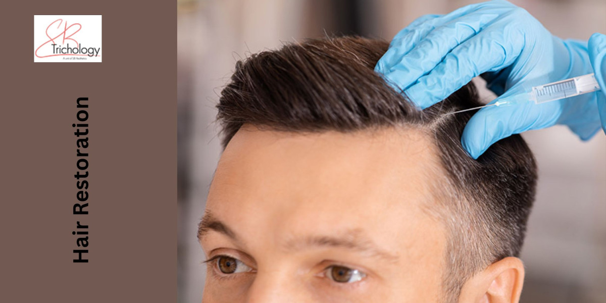 Hair Transplant Myths vs. Reality