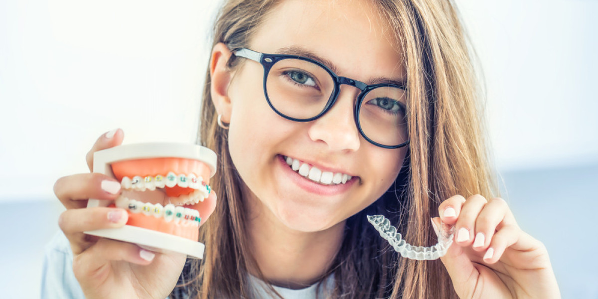 Straight Teeth, No Hassle: Invisalign Braces Revolution in Arlington, VA