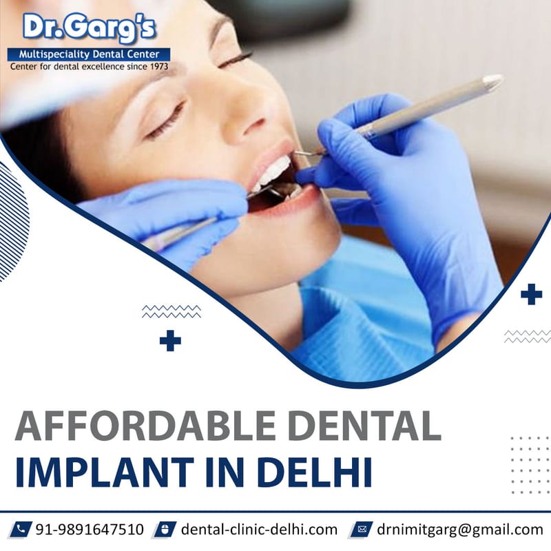 Revolutionize Your Smile with Dental Implants at Dr. Garg's Multispeciality Clinic