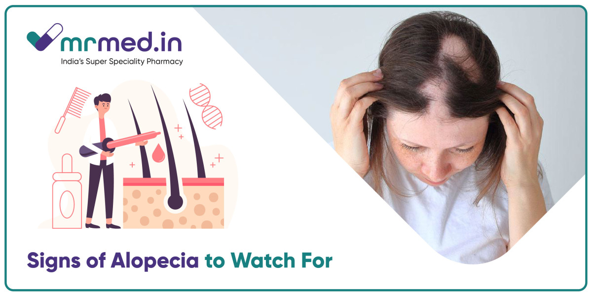 What Are the Early Symptoms of Alopecia?