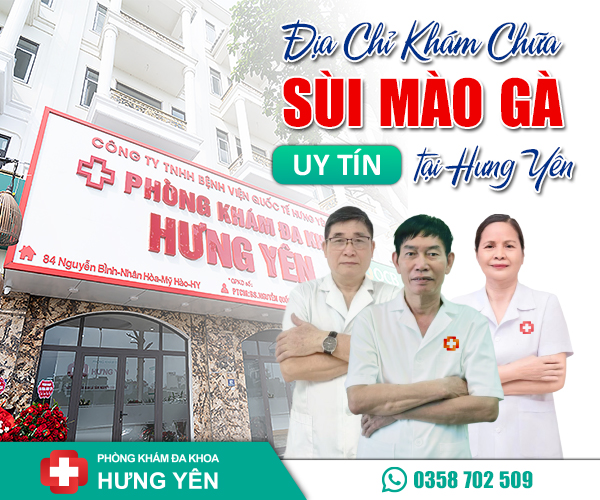 Địa chỉ chữa sùi mào gà uy tín ở Hưng Yên |