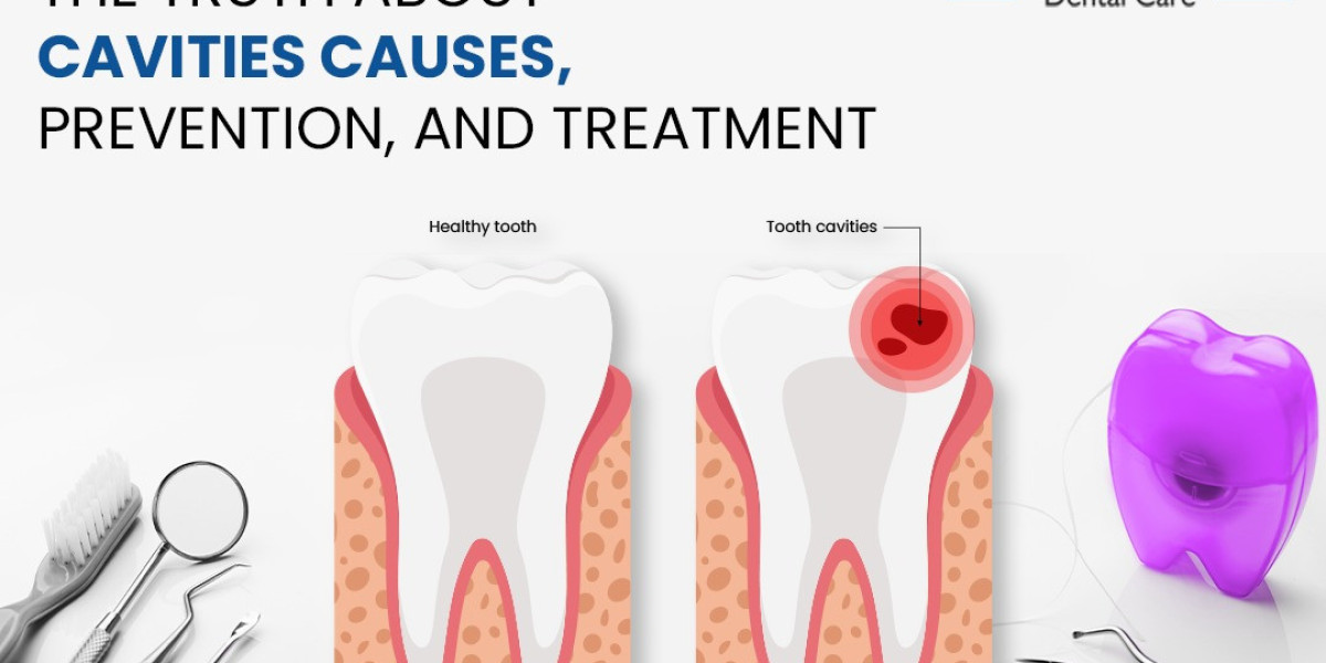 The Truth About Cavities: Causes, Prevention, and Treatment