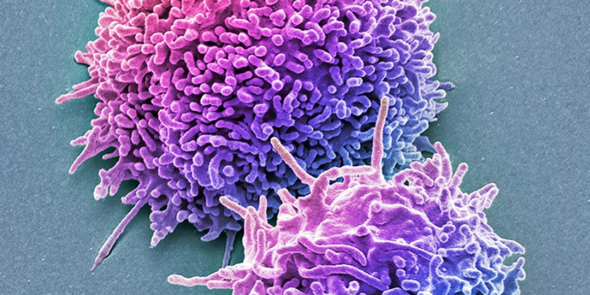 Idiopathic CD4+ Lymphocytopenia is Estimated to Witness High Growth Owing to Advancements in Diagnostic Testing