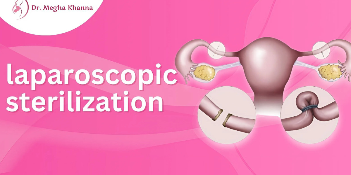 What is Laparoscopic Sterilization?