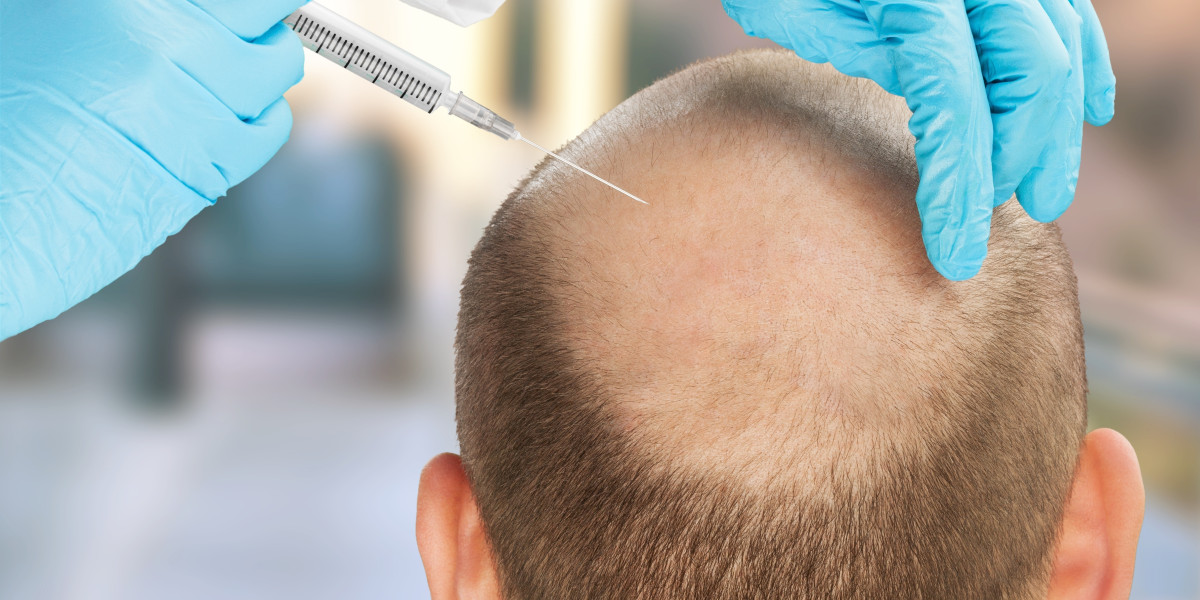 Affordable Hair Transplant Cost in Jodhpur - Get the Best Results