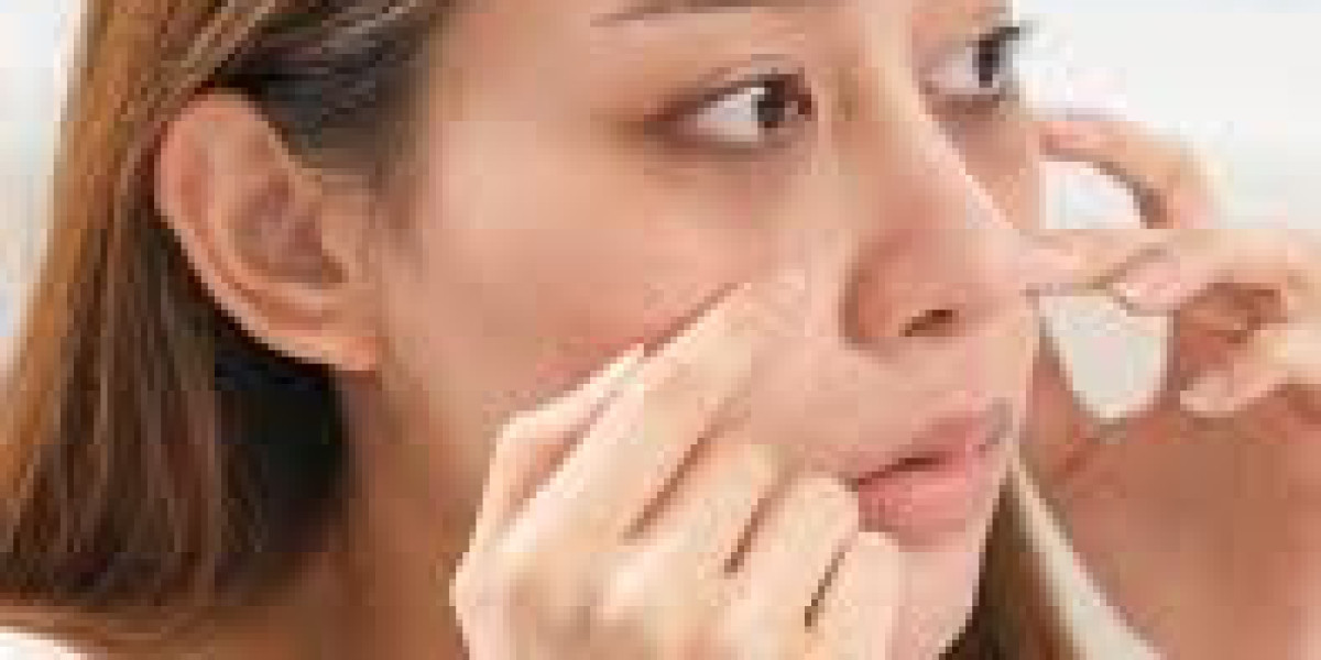 Do Home Remedies Really Work for Dark Circles?