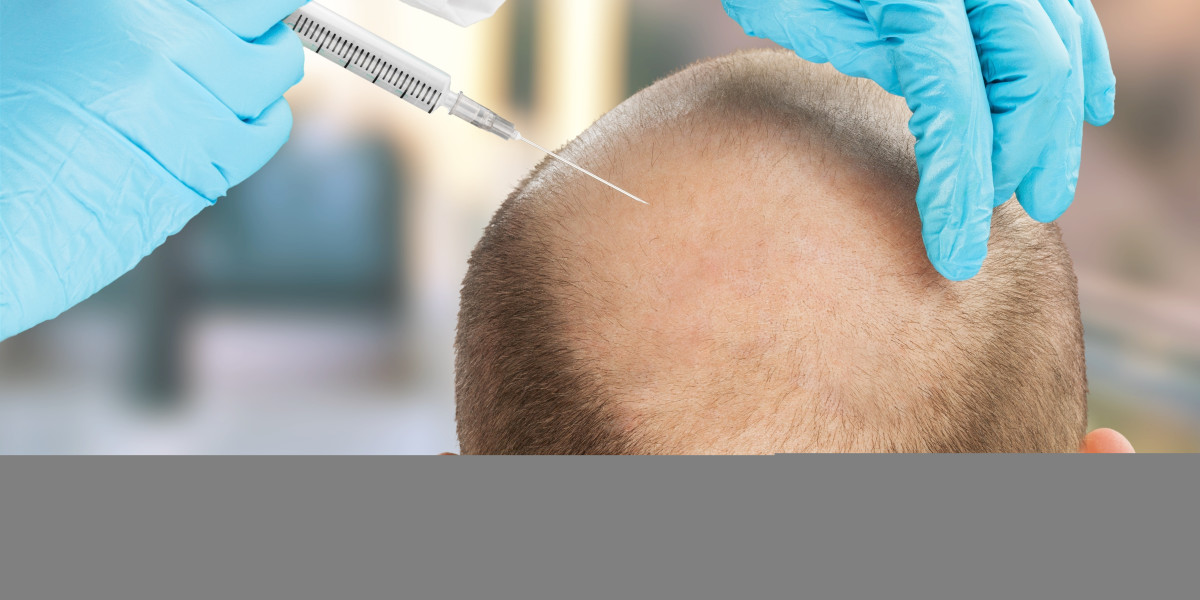 Hair Transplant in Jaipur: Your Guide to a Perfect Transformation