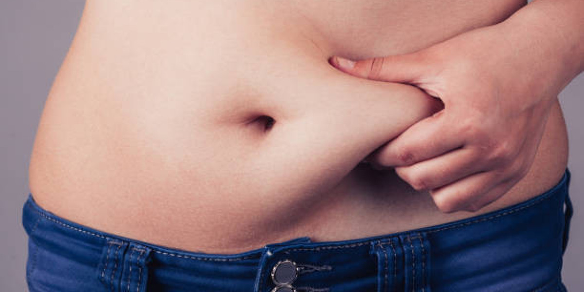 Understanding the Risks and Side Effects of Liposuction in Islamabad