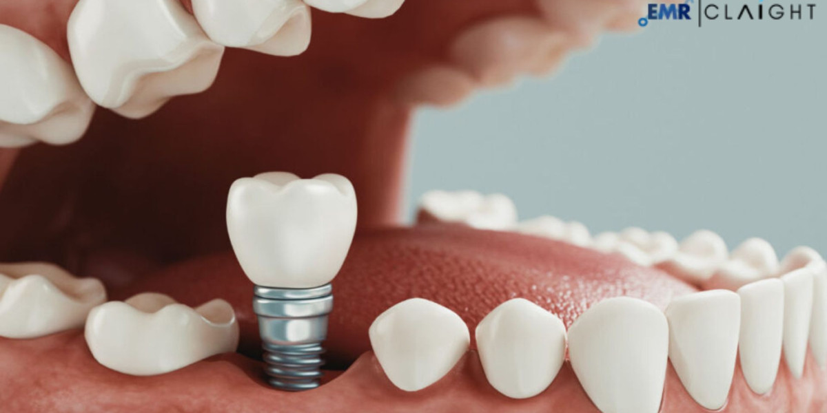 Global Dental Tourism Market Trend, Share, Size & Growth | 2034