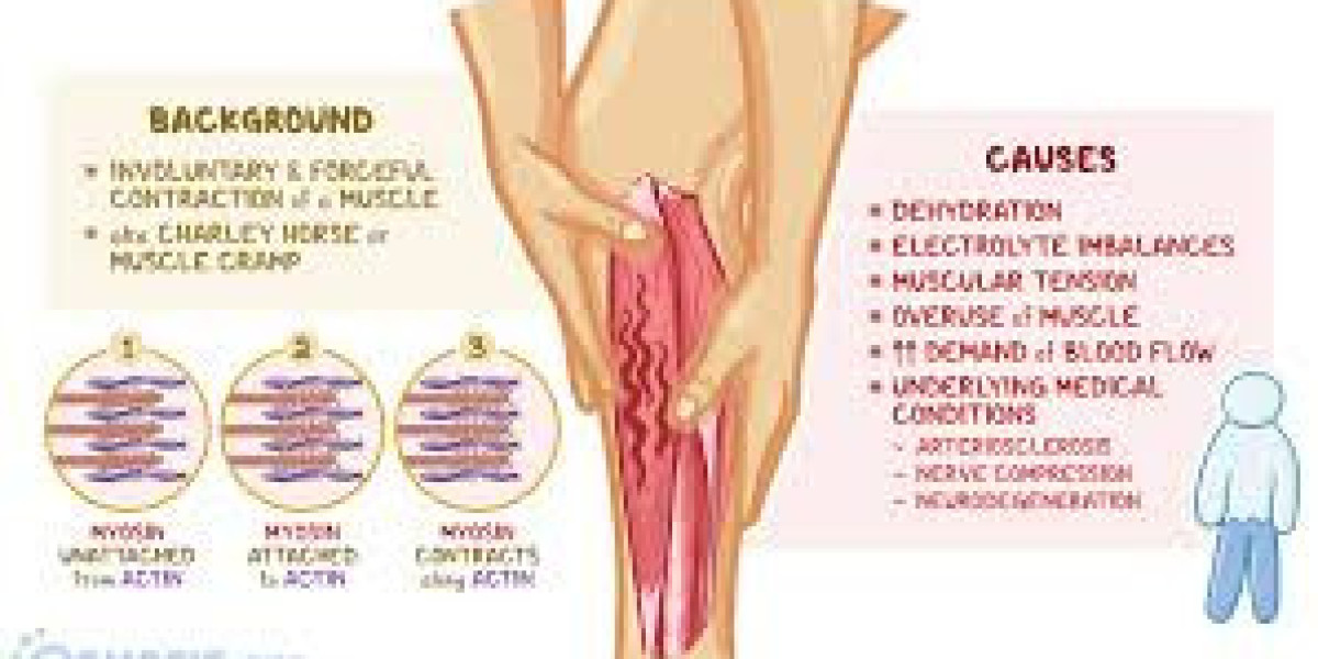 Understanding Muscle Spasms: Overuse as a Common Cause