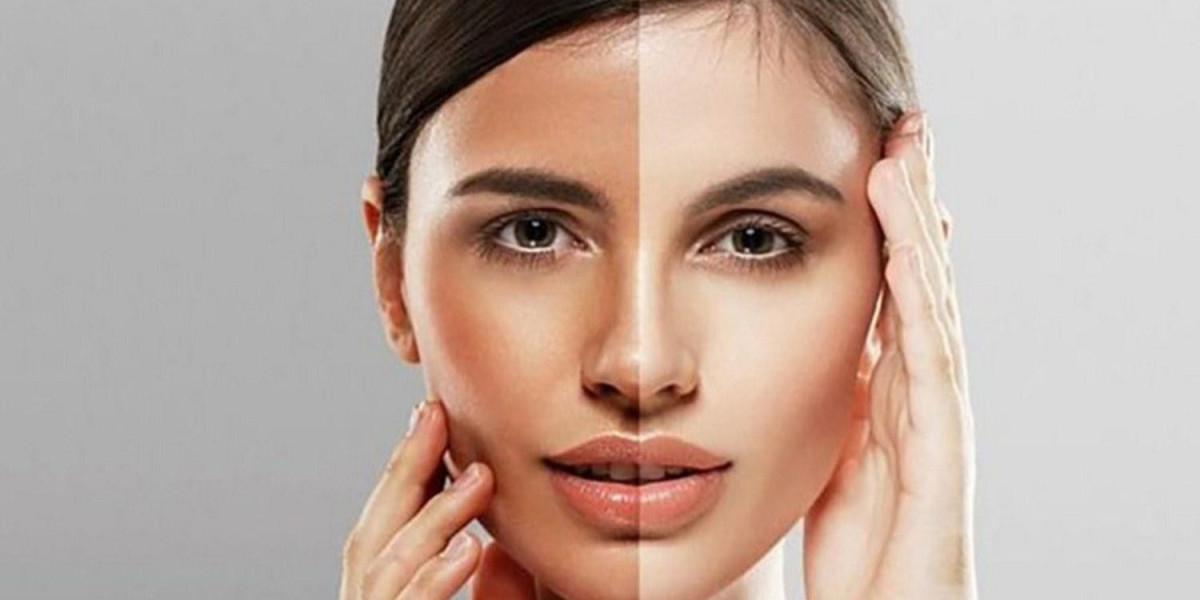 How Long Does It Take to See Results from Skin Toning Treatment?