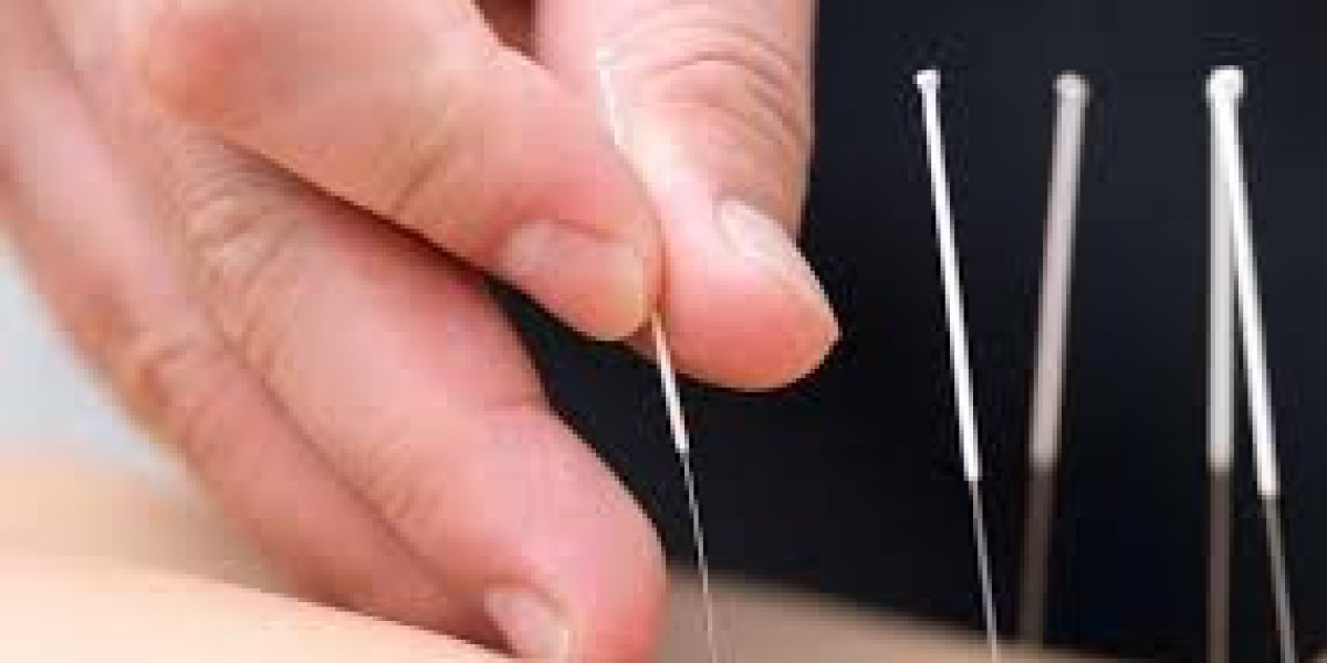 Is Acupuncture Effective for Sports Injuries and Pain Relief?