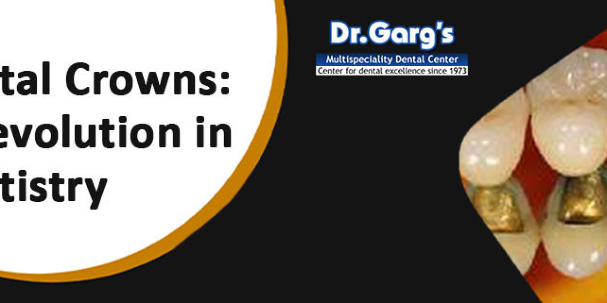 Dental Crowns: A Revolution in Dentistry