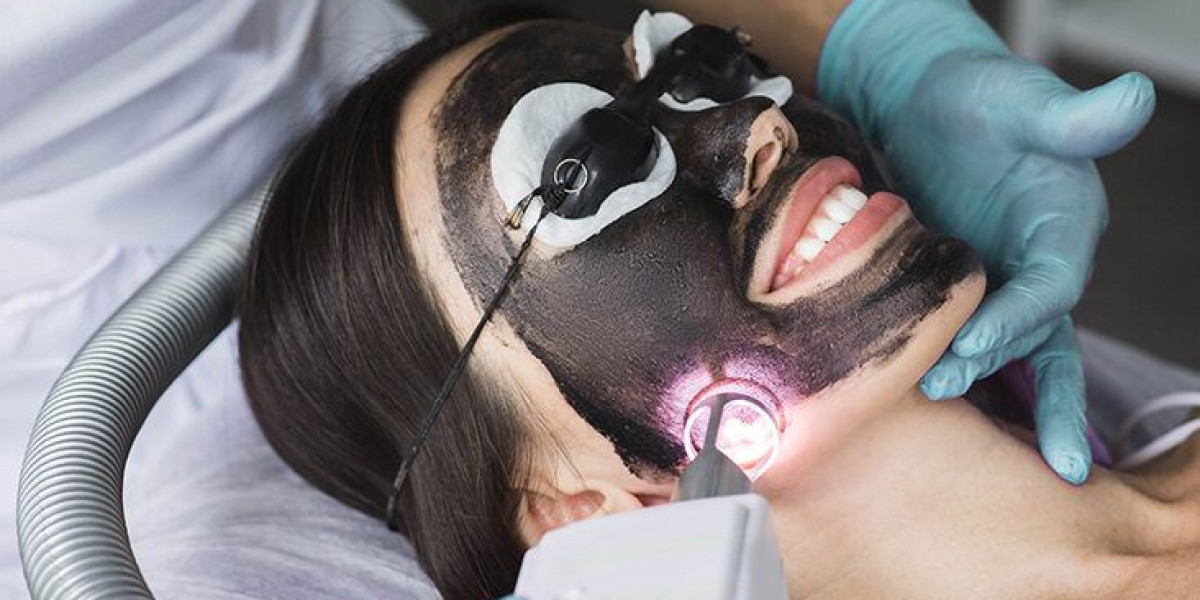 Laser Carbon Peel in Dubai: The Future of Skin Rejuvenation