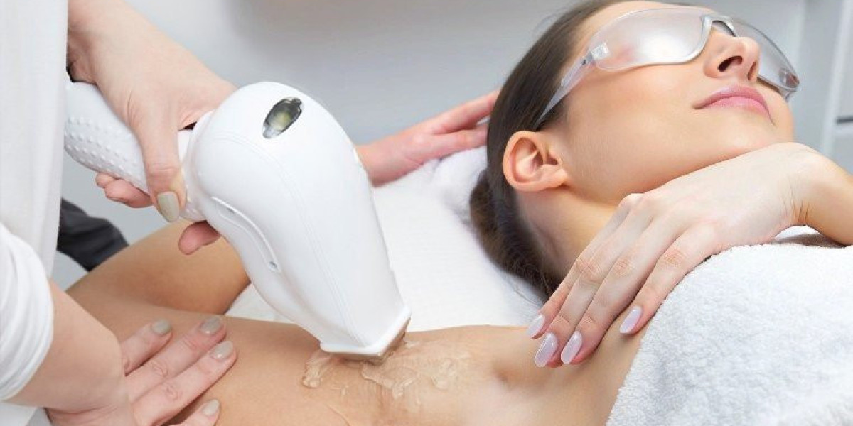 Say Goodbye to Unwanted Hair: Best Laser Hair Removal in Dubai