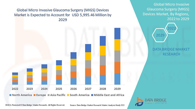 Micro Invasive Glaucoma Surgery (MIGS) Devices Market at a CAGR of 33.3% during the forecast period