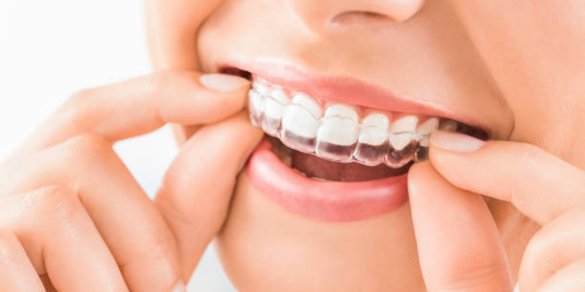 The Perfect Smile: Exploring the Benefits of Invisalign in West Covina