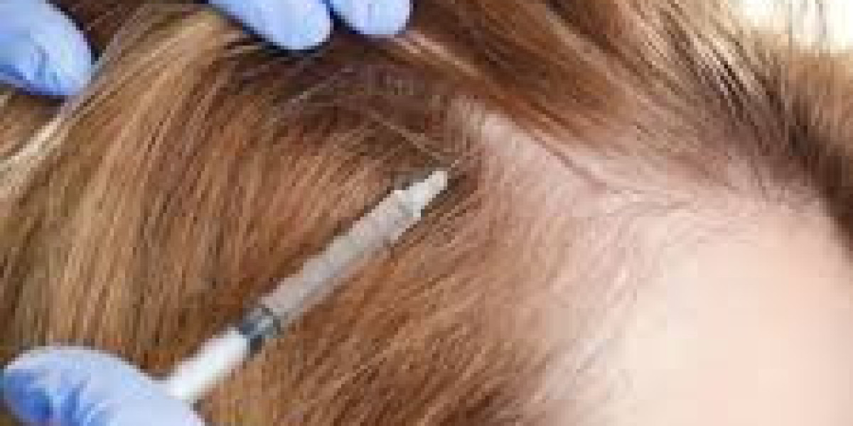 PRP Therapy in Riyadh: The Ultimate Solution for Hair Thinning