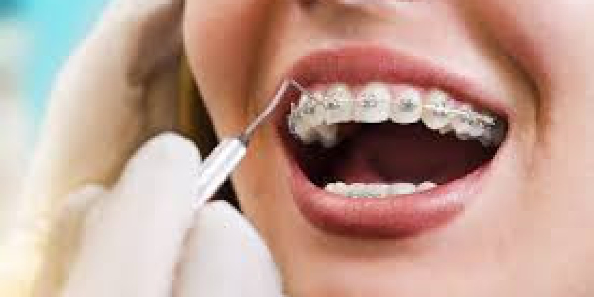 Invisalign Retainer in Caldwell, Idaho: A Clear Path to a Better Smile