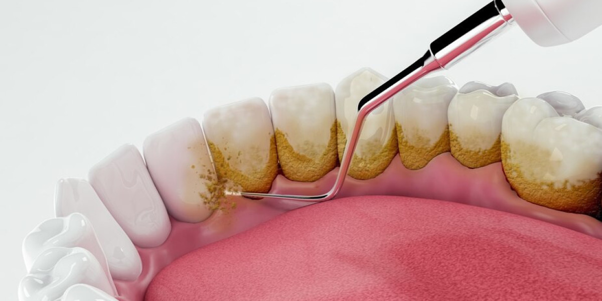 The Benefits of Laser Dentistry in Billings, MT for the Whole Family
